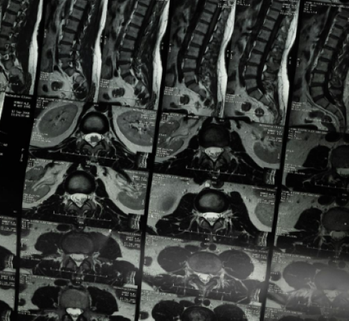 Tantalum Capillaries in Medical and Biomedical Devices